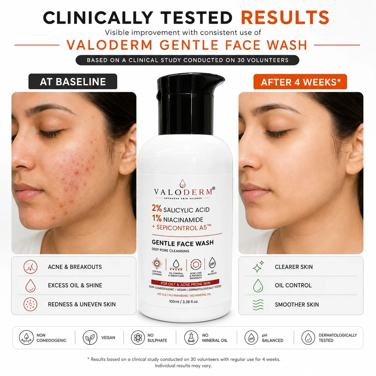Clinical results: skin at baseline and after 4 weeks with VALODERM Gentle Face Wash, from a study on 30 volunteers